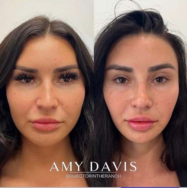 Short + Simple Glow-Up transformation